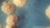 WHO Launches Drive To Halt Rise Of Drug-Resistant TB